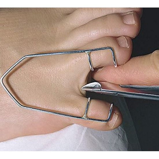 Séparateur dorteils en métal, pour podologue, problèmes difficiles à atteindre, pour pédicure-3756-18-05-Foot care-Tout pour la manucure