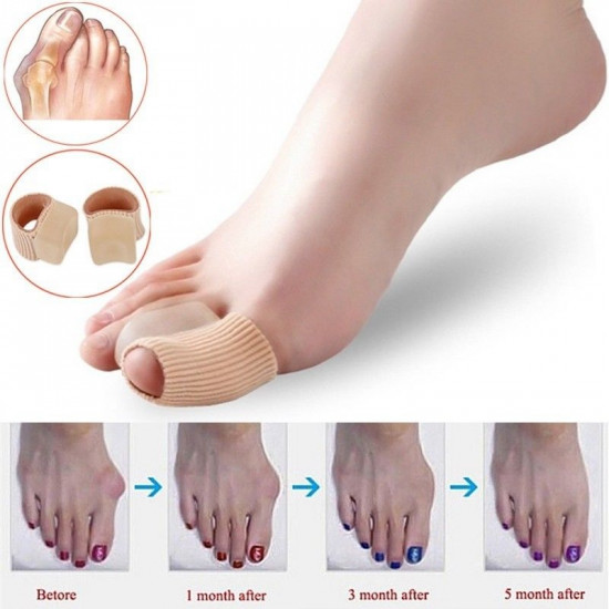 Inter-finger septum, corrector for deformation of fingers, inter-finger, gel divider, on a tissue basis, P-20-5, Subology, All for a manicure,Subology , buy with worldwide shipping Inter-finger septum, corrector for deformation of fingers, inter-finger, gel divider, on a tissue basis, P-20-5, Subology, All for a manicure,Subology , buy with worldwide shipping