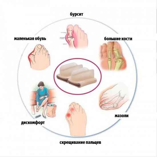 Inter-finger septum, corrector for deformation of fingers, inter-finger, gel divider, on a tissue basis, P-20-5, Subology, All for a manicure,Subology , buy with worldwide shipping Inter-finger septum, corrector for deformation of fingers, inter-finger, gel divider, on a tissue basis, P-20-5, Subology, All for a manicure,Subology , buy with worldwide shipping