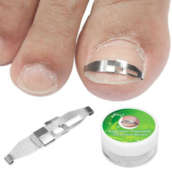 Hebilla de acero inoxidable reutilizable # 42 para corrección, corrección, fijación de uñas encarnadas y torcidas-952744924-Foot care-Podología