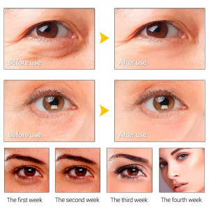 Anti-aging Peptide Roller Cream Serum voor oogcontour Lanbena Peptide rimpel oog Serum