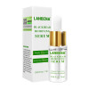 Lanbena15ml soro removedor de cravo poros profundos Cravo Pimple poupando tratamento da Acne Diminuir Os Poros Limpeza Cuidados-952732853-Lanbena-Beleza e saúde. Tudo para salões de beleza