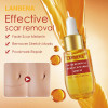 Lanbena removedor de cicatriz estrias removedor anti anti diminuir os Poros Cravo Remoção-952732854-Lanbena-Beleza e saúde. Tudo para salões de beleza