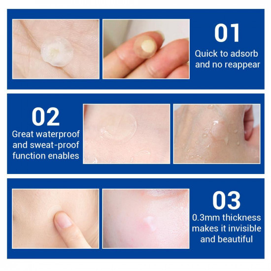 Nachtpatches voor acnebehandeling, Acne, Lanbena, puist,  s nachts, behandeling, Gezichtsmasker Huidverzorging Schoonheid-952732864-Lanbena-Schoonheid en gezondheid. Alles voor schoonheidssalons