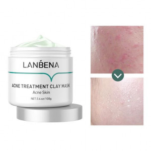 Lanbena kleimasker voor acnebehandeling voor diepe reiniging, poriënreiniging, zwarte bladreductie en acne om de schone huid te herstellen